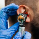 Emicrania e acufeni: le terapie anti-CGRP e anti-emicrania utili per l’acufene?